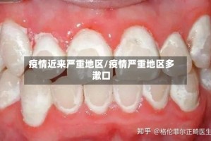 疫情近来严重地区/疫情严重地区多漱口