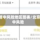 北京疫情中风险地区图表/北京 疫情中风险