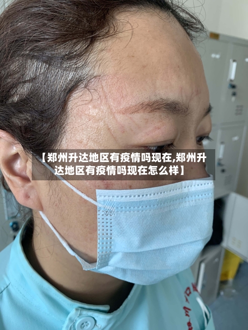 【郑州升达地区有疫情吗现在,郑州升达地区有疫情吗现在怎么样】-第1张图片